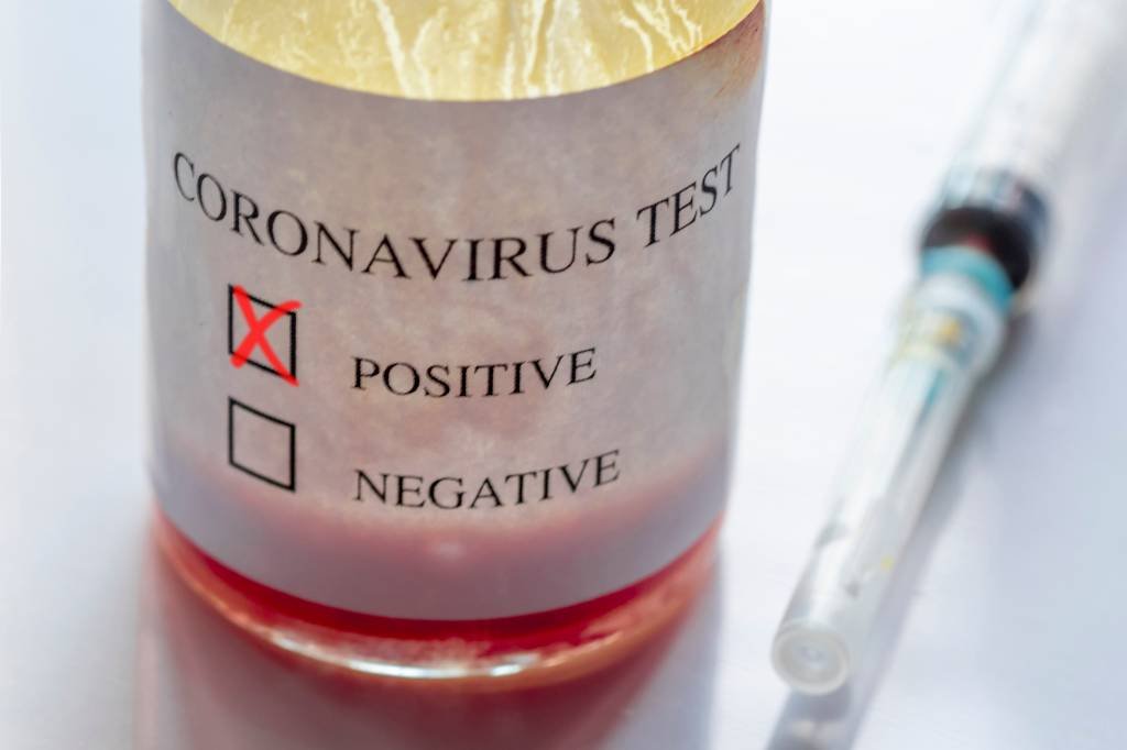 Aplicativo do governo avalia se você pode estar infectado com coronavírus