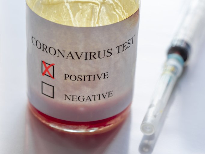 Coronavírus: paciente que morreu não estava em lista de casos confirmados