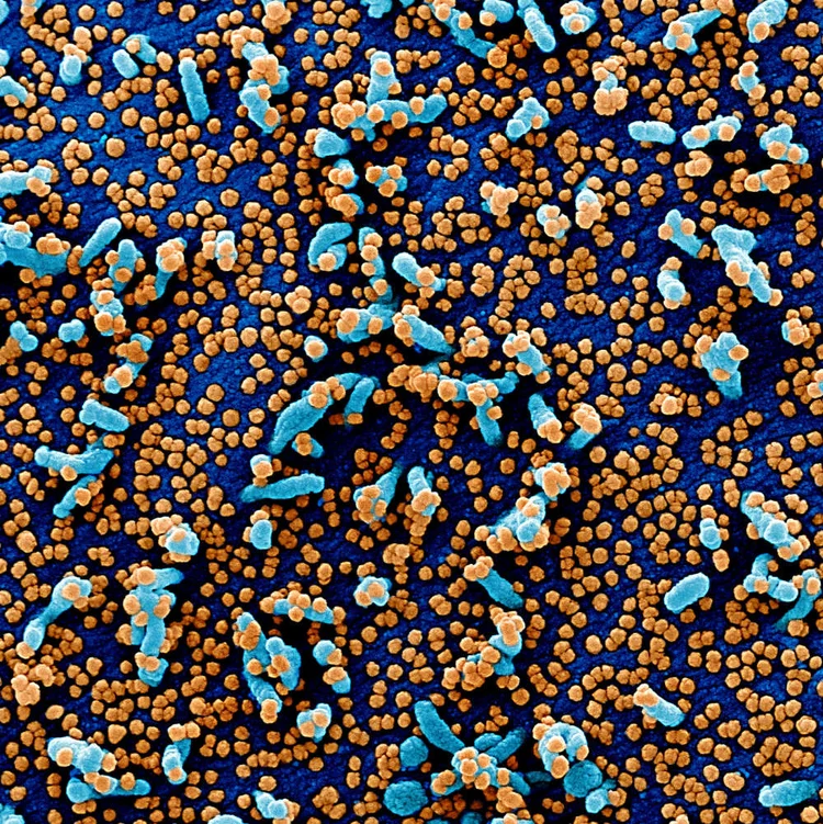 Coronavírus: vírus ainda não tem tratamento clínico aprovado e vacina ainda está em estágio inicial de criação (Flickr/Instituto Nacional de Alergia e Doenças Infecciosas dos Estados Unidos/Divulgação)