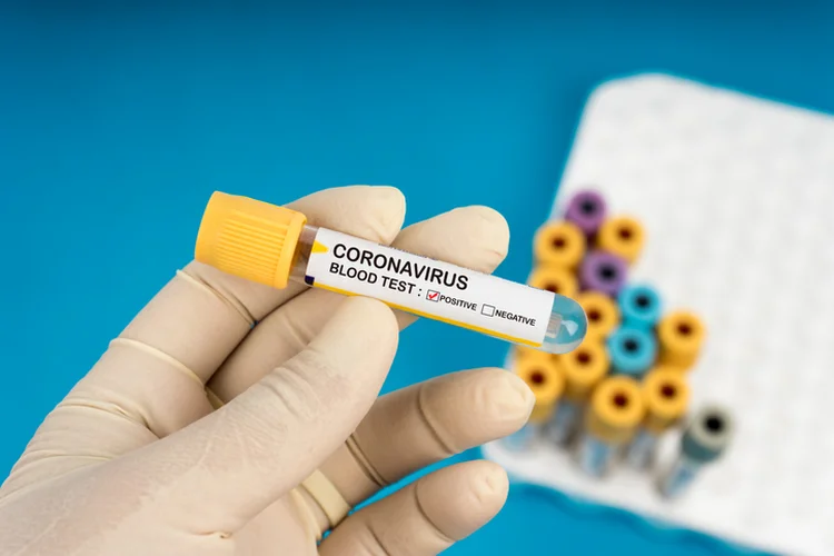 Coronavírus: estudo demonstra como vírus infecta humanos (Jasni Ulak / EyeEm/Getty Images)