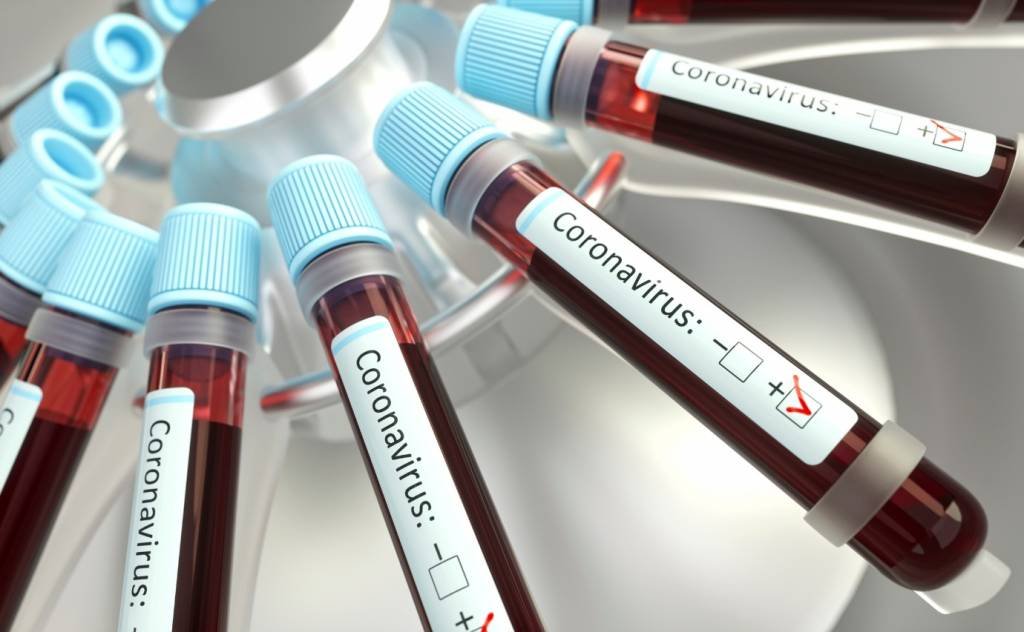 SP torna obrigatória notificação de hospitais privados sobre coronavírus