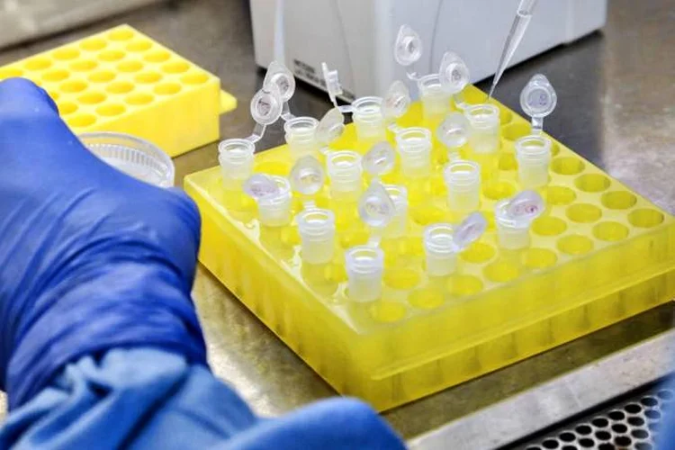 O teste sorológico possui até 100% de sensibilidade na detecção de anticorpos contra o covid-19 e especificidade maior que 99,8% para o SARS-Cov-2 (IOC/Fiocruz/Divulgação)