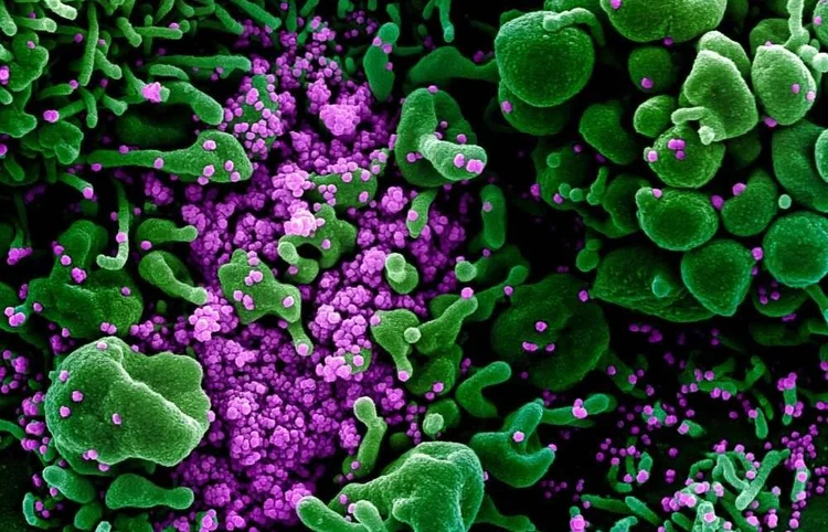 Vírus: Fiocruz alerta que 173 tipos de patógenos podem causar ao menos 76 doenças em seres humanos (Flickr/Instituto Nacional de Alergia e Doenças Infecciosas dos Estados Unidos/Divulgação)