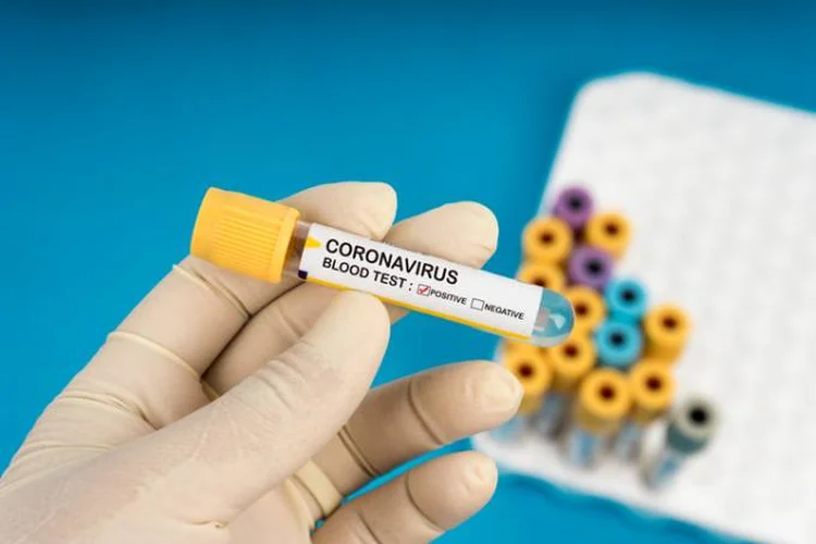 Exame de coronavírus: novas tecnologias eliminam fase de extração, que enfreta falta de insumos (Jasni Ulak / EyeEm/Getty Images)