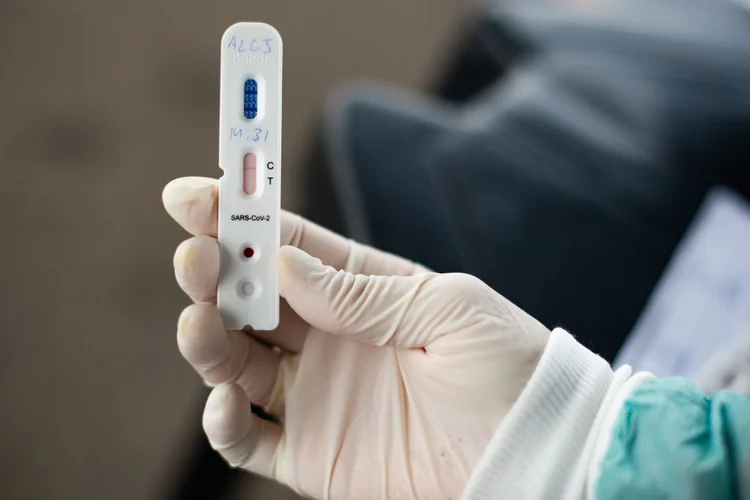 Testes: O próprio setor privado deve adquiri os exames, que só podem ser os aprovados pela Anvisa (Andressa Anholete/Getty Images)