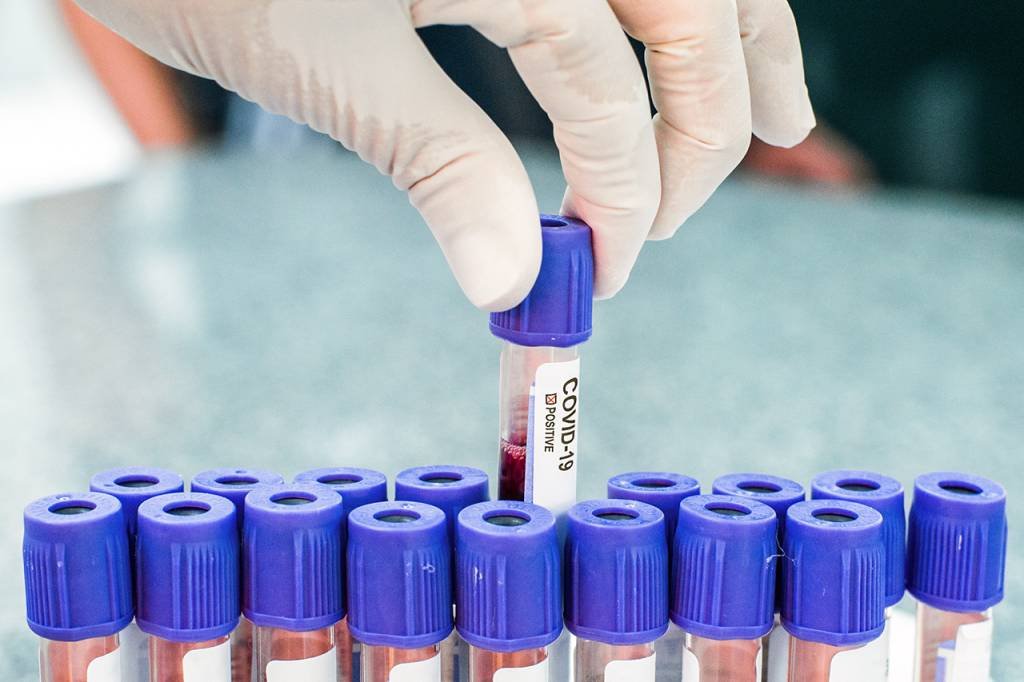 Testes de coronavírus (covid-19) (Lucas Ninno/Getty Images)
