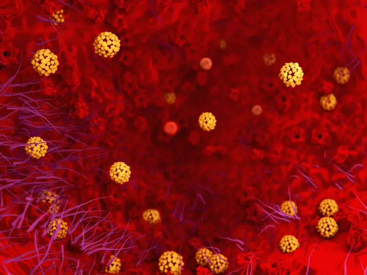 The coronavirus causes the severe illness SARS (Severe Acute Respiratory Syndrome). The viruses penetrate into the body cells by anchoring to a protein of the cell membranes. (selvanegra/Getty Images)
