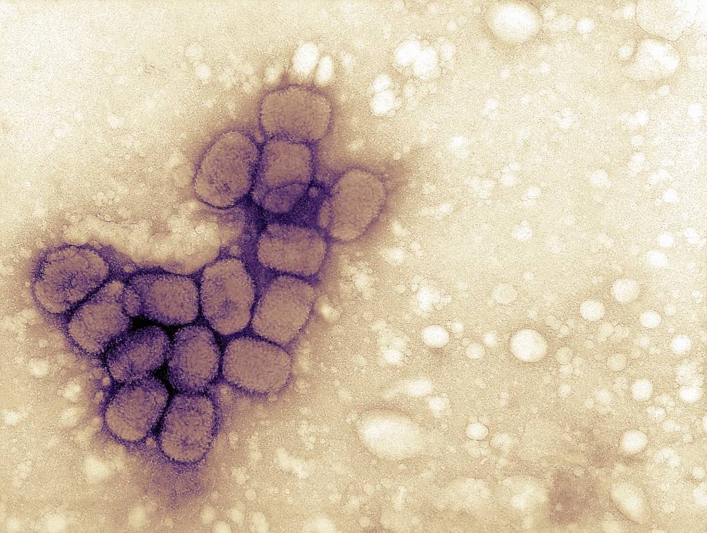té o momento, 16 países já registraram casos da varíola de macacos (Callista Images/Getty Images)