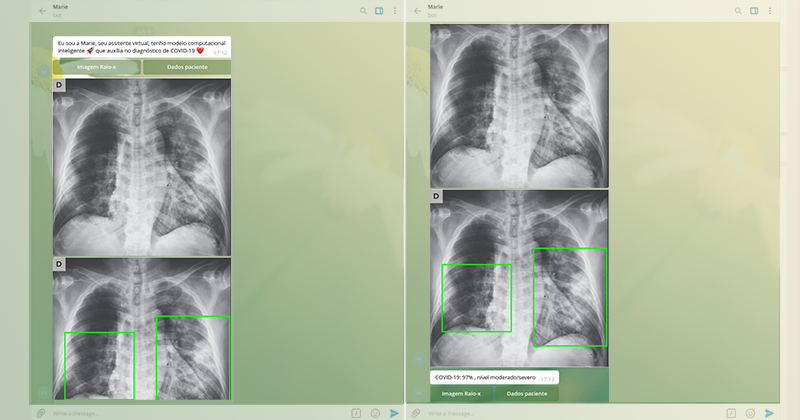 App da USP faz diagnóstico da covid-19 a partir de radiografia do pulmão