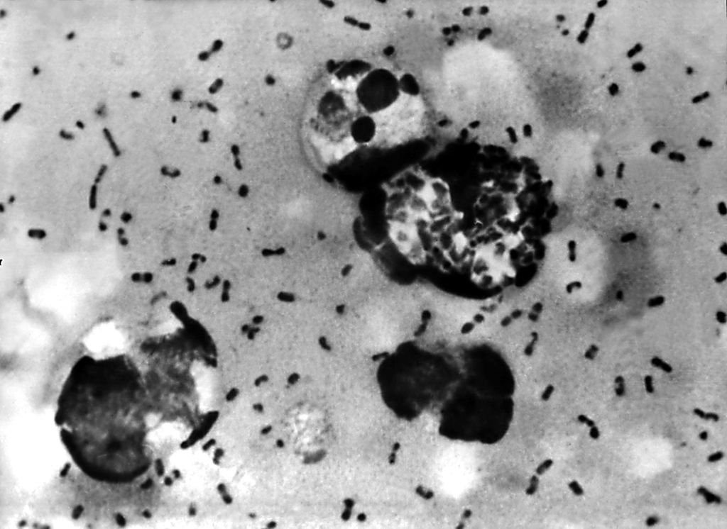 Yersinia pestis: vírus da peste bubônica dizimou a Europa no século 14 (Centers for Disease Control and Prevention/Getty Images)