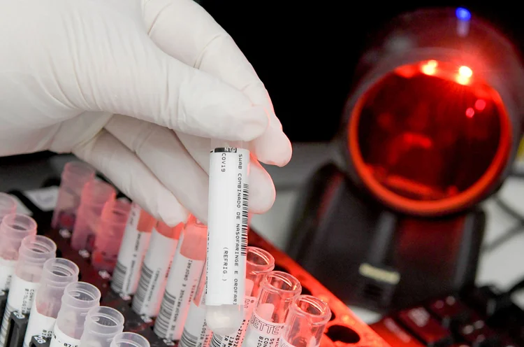 Covid-19: estudo foi realizado com amostras post mortem (Washington Alves/Reuters)