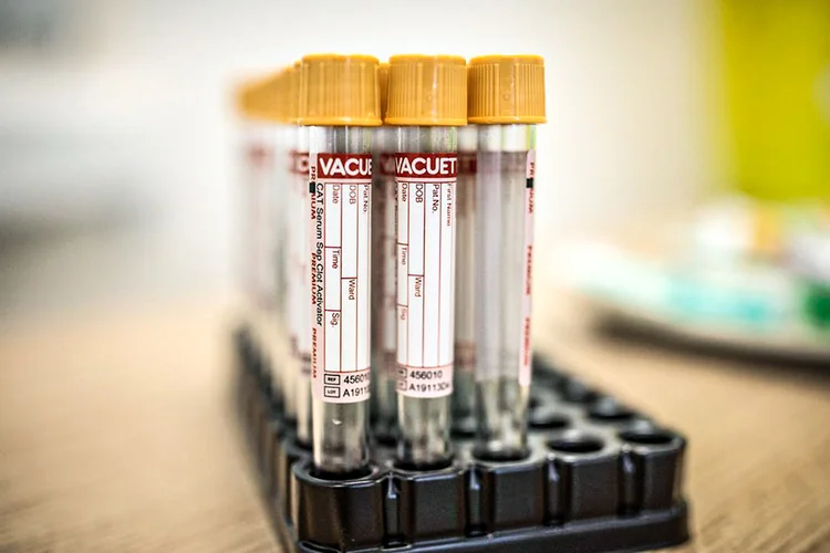 Vacinas: informações foram dadas pelo CEO da farmacêutica, Pascal Soriot, durante uma conferência privada com investidores (Reuters/Reuters)