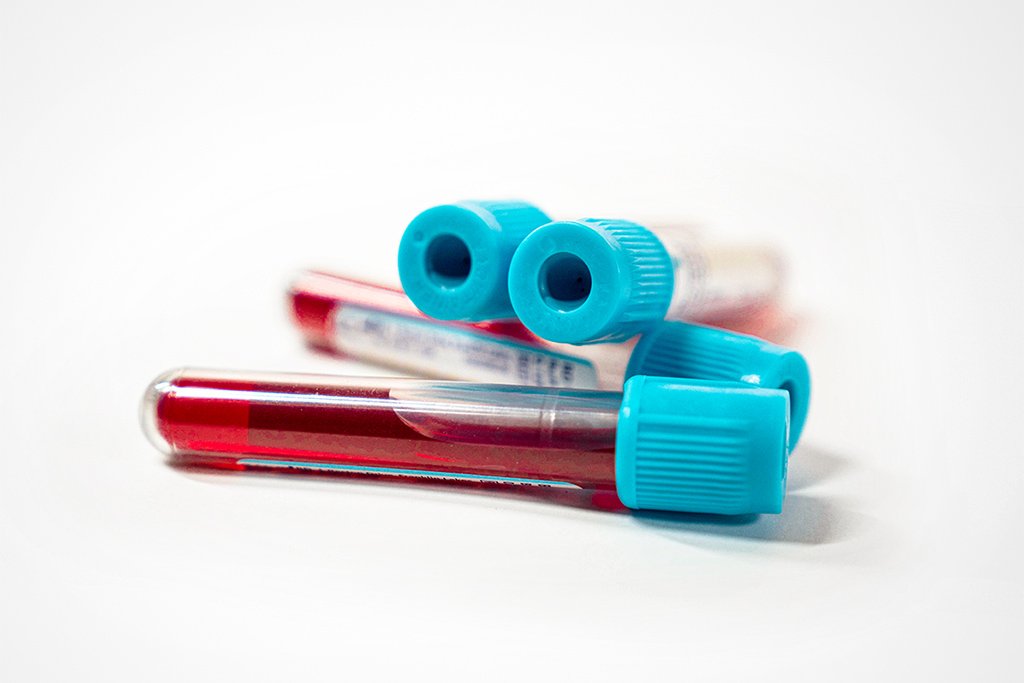 Biópsia líquida: amostra de sangue fornece ao médico informações necessárias para tratamento personalizado (Michael Melchiorre/Getty Images)
