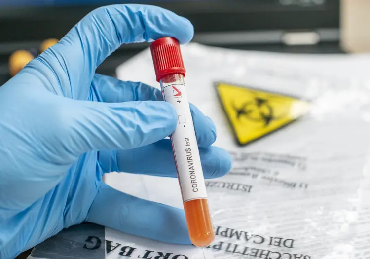 Covid-19: exame de sangue pode ajudar a prever reação mortal da doença (Paul Biris/Getty Images)