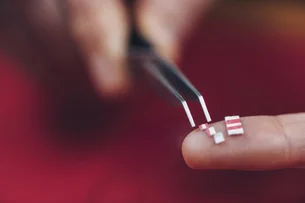 LSD reduz ansiedade por até 3 meses em quase metade dos pacientes, aponta estudo
