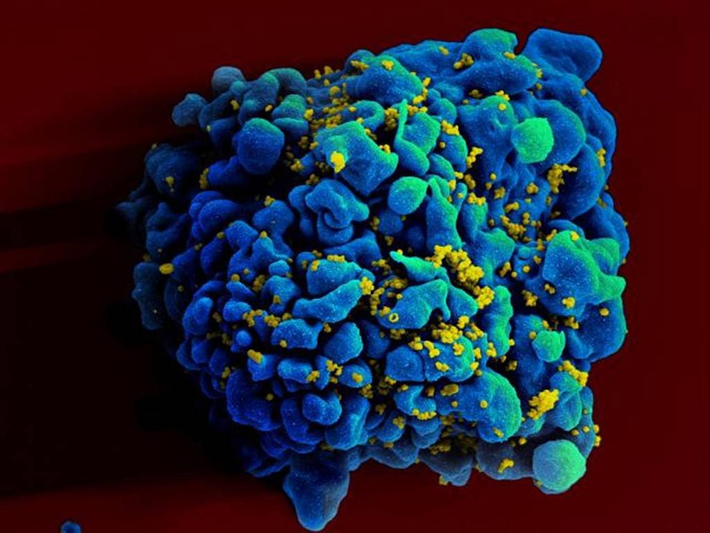 Vírus raro encontrado na Bolívia pode ser transmitido entre humanos