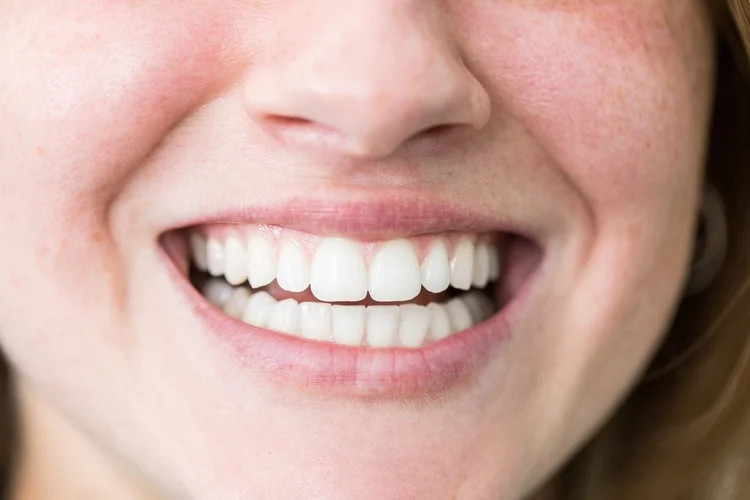 Sorriso bonito muda a carreira (Luis Alvarez/Getty Images)