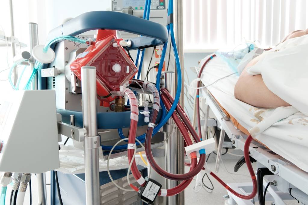 Saiba como funciona a ECMO, terapia que auxilia pacientes graves com covid