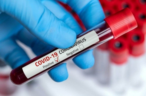 Grupo Sabin aplica teste que detecta resposta imune ao coronavírus