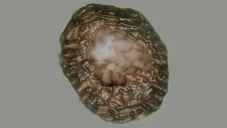 Imagem aprimorada do fóssil de um bilhão de anos por microscópio mostra uma parede externa de células envolvendo uma massa celular interna (P.K Strother/Boston College/Reprodução)