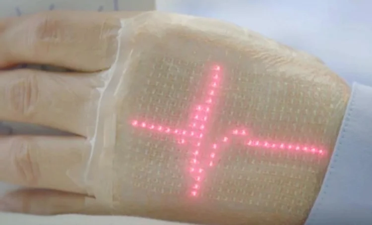 A pele eletrônica da Samsung aplicada em uma mão (Foto/Reprodução)