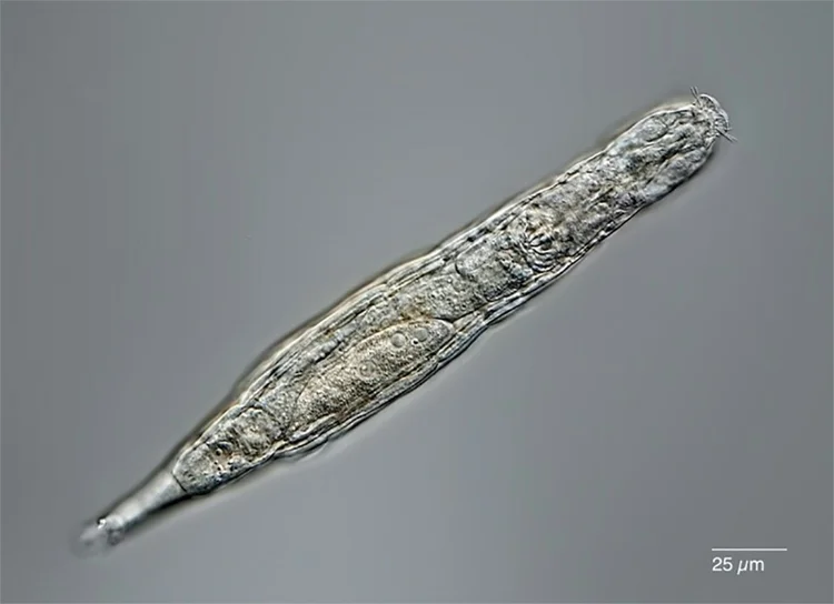 Animal microscópico: os rotíferos agora podem ser adicionados à lista de organismos que aparentemente podem sobreviver indefinidamente, disse Malavin (AFP/AFP)