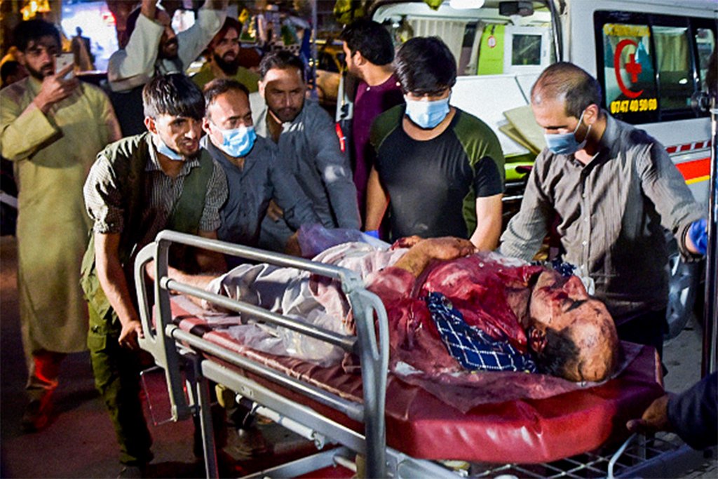 Vítima de atentado terrorista é socorrida em Cabul, no Afeganistão (WAKIL KOHSAR/AFP via Getty Images/Getty Images)