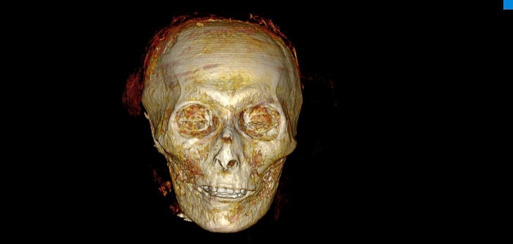 Pesquisadores descobrem segredos de múmia sem remover bandagens