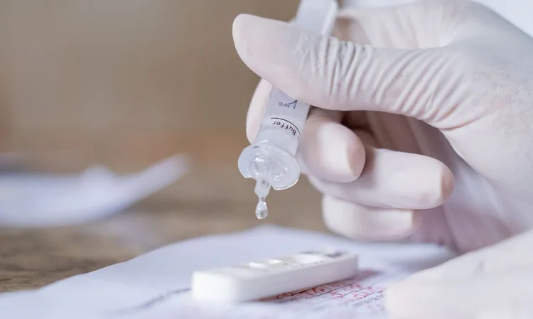 “As investigações apontaram indícios de que alguns laboratórios sediados na cidade catarinense teriam aplicado testes-rápidos de covid-19 nos cidadãos como se fossem do tipo RT-PCR, que é mais complexo e mais caro para os cofres públicos. (Myke Sena/MS/Agência Brasil)
