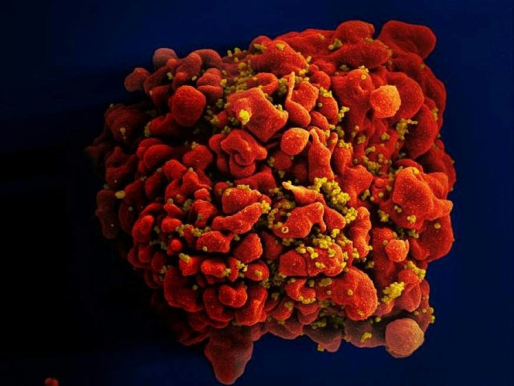 Cientistas descobrem nova variante mais transmissível do HIV