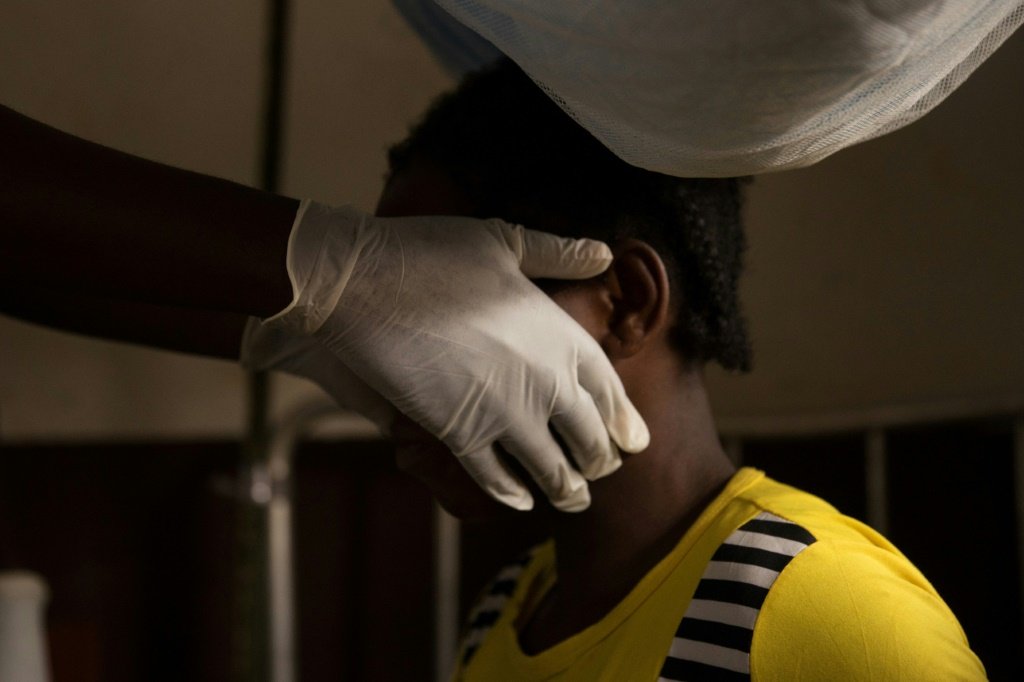 Paciente infectada com a varíola do macaco é examinada em Zomea Kaka, na República Centro-Africana, em 18 de outubro de 2018 (AFP/AFP Photo)
