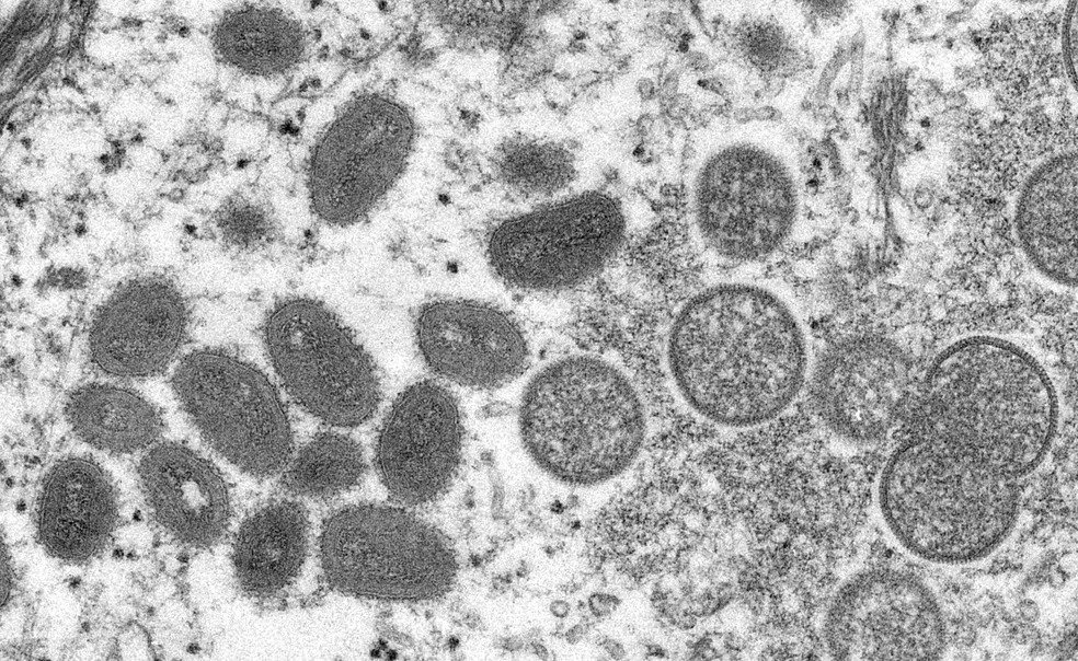 Monkeypox: vírus que causa varíola dos macacos teve sequenciamento genético feito pela Fiocruz (Centro de Controle de Doenças/Divulgação)
