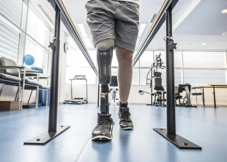 Prótese: pacientes submetidos a amputações, inclusive no SUS, conseguem ter sobrevida muito parecida com pacientes normais, com qualidade de vida. (Johnny Greig/Getty Images)