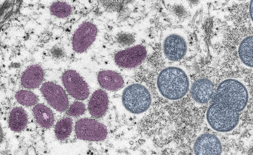 Total de casos de varíola dos macacos no Brasil sobe para 37