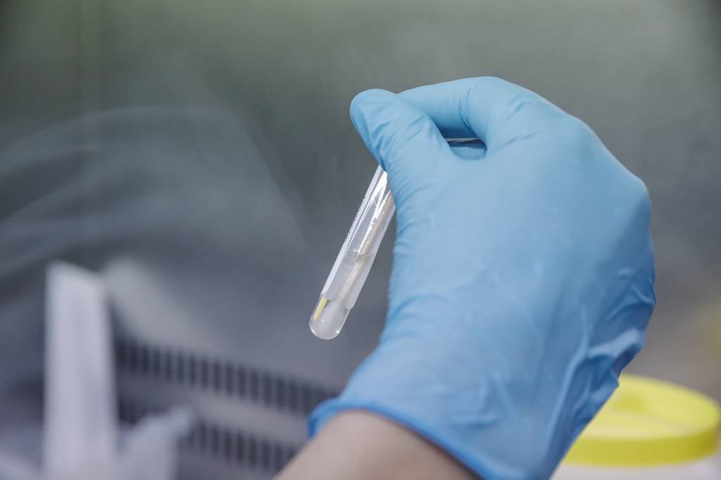 Teste para diagnóstico de covid longa é aprovado na Europa; entenda como funciona