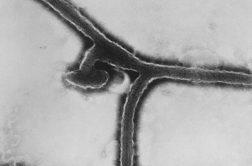 Marburg: O vírus é transmitido aos humanos por morcegos frugívoros e se espalha entre os humanos por meio do contato direto com os fluidos corporais de pessoas (Smith Collection/Getty Images)
