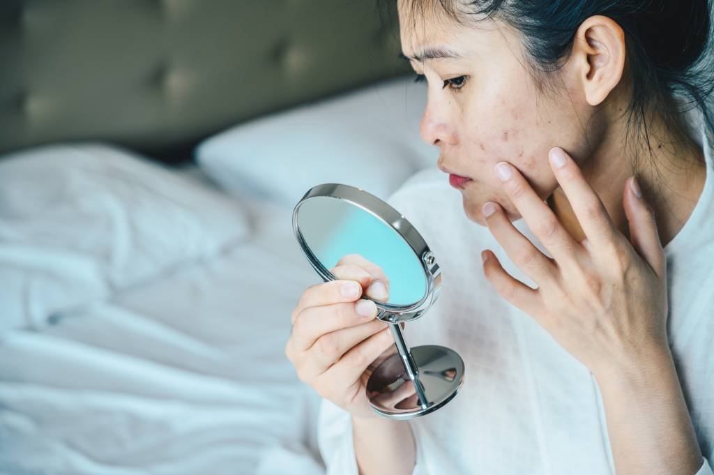 Close up of Asian woman worry about her face when she saw the problem of acne and scar by the mini mirror.
