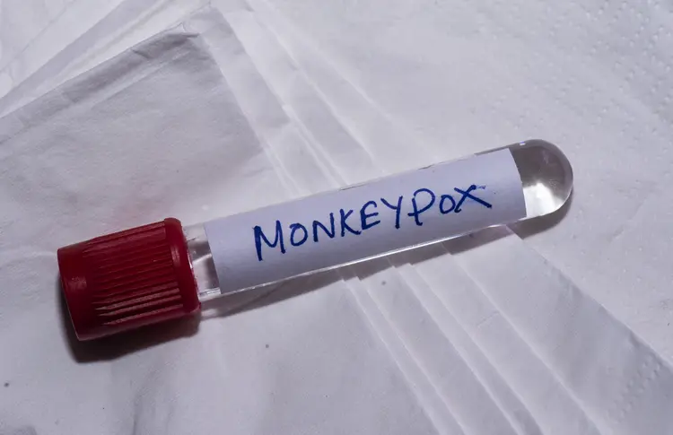 Monkeypox: há vacina disponível para grupos vulneráveis. (Divulgação/Getty Images)