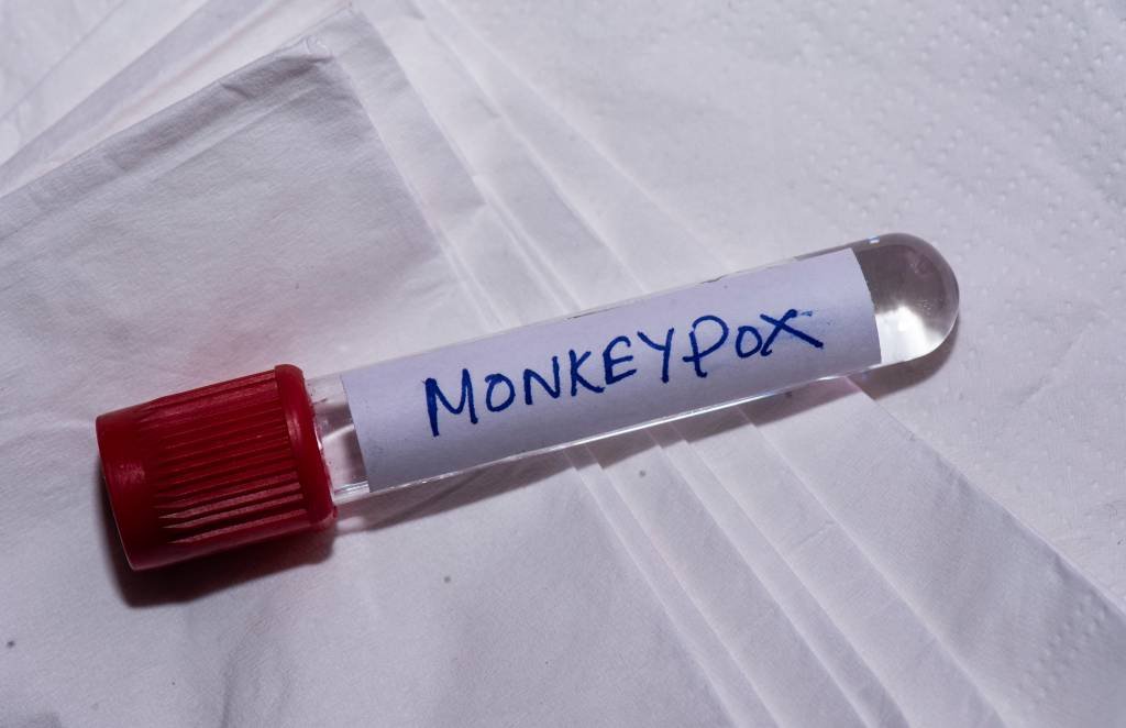 OMS mantém nível máximo de alerta para varíola dos macacos