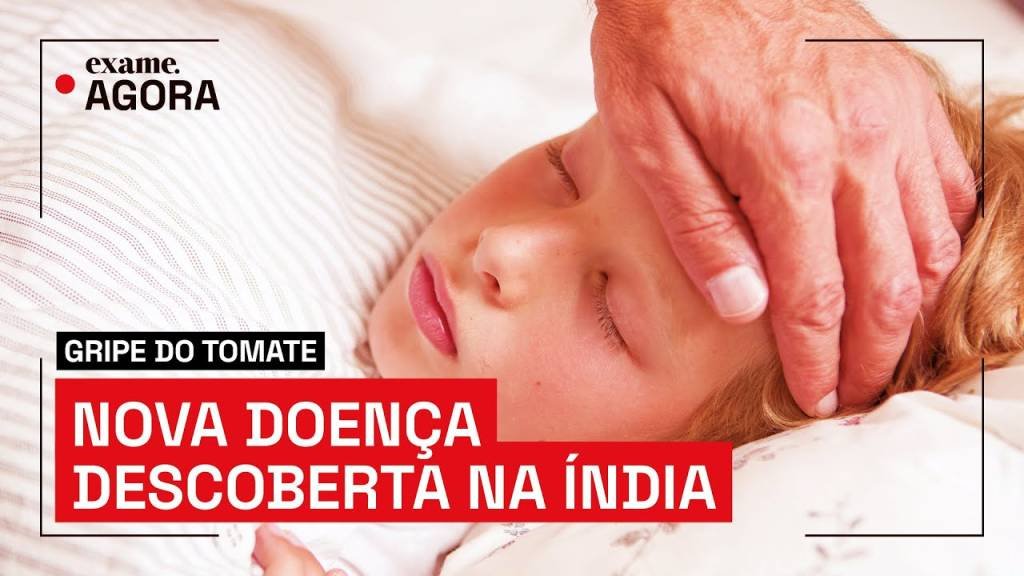 Gripe do tomate: o que se sabe sobre doença identificada na Índia