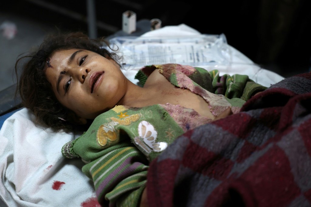 Síria: criança ferida recebe tratamento no acampamento de deslocados de Maram (AFP/AFP Photo)
