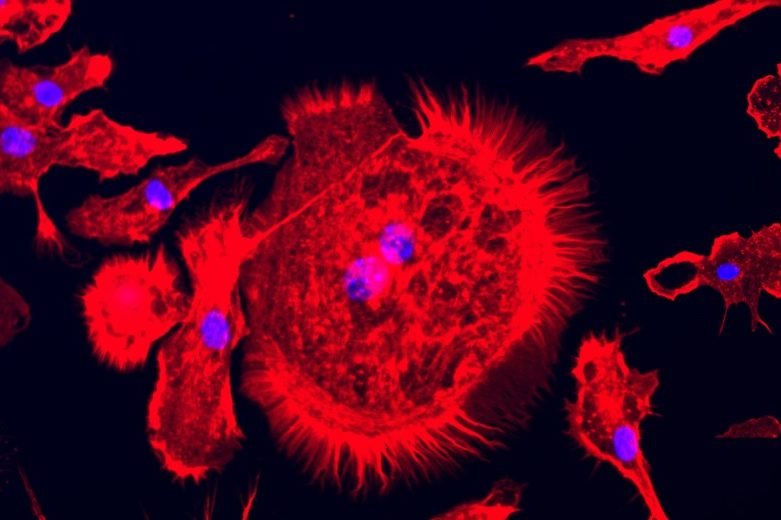 NFTs de células cancerígenas buscam arrecadar fundos para tratamento do câncer