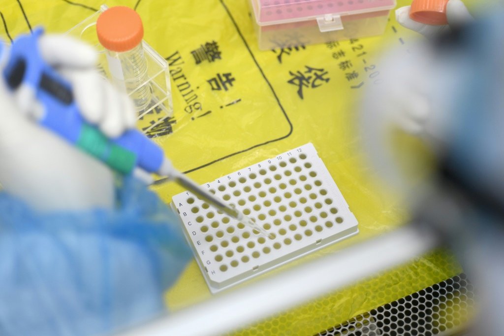 Diretor de FBI diz que pandemia 'provavelmente' foi provocada por acidente em laboratório de Wuhan
