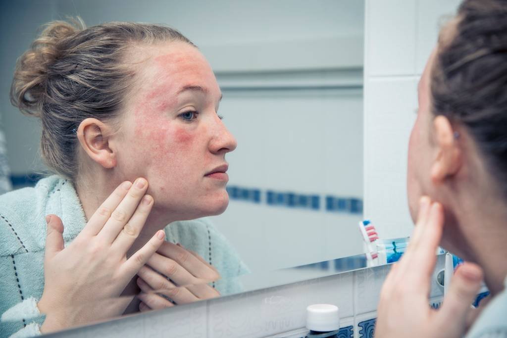 Cuidados com a pele no frio: veja como evitar o ressecamento e intensificar a hidratação