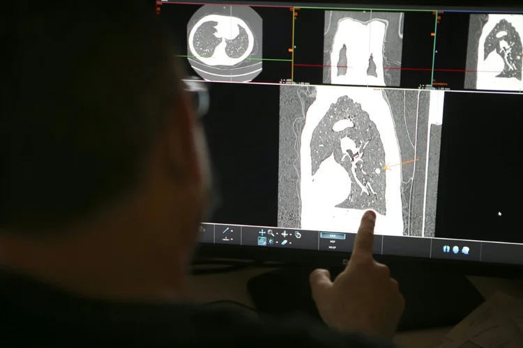 Imagem de uma radiografia de pulmão como parte de um programa de rastreamento de câncer de pulmão na França em 2021 (AFP/AFP)