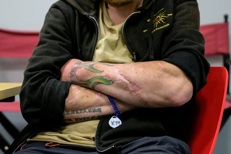 Martin, um dependente químico de 45 anos, no centro médico St. Ann's Corner of Harm Reduction, em Nova York, em 25 de maio de 2023 (Diane DESOBEAU, Andréa BAMBINO/AFP)