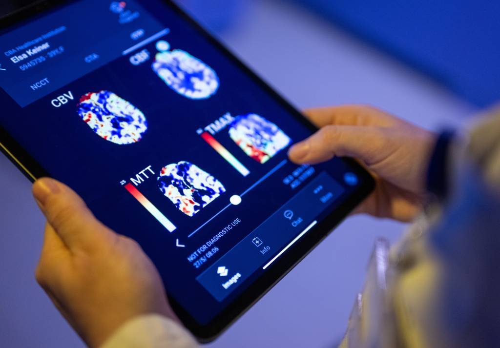 Google e Bayer anunciam IA que ajudará radiologistas a analisarem imagens
