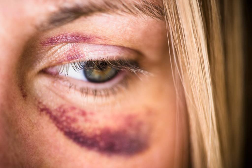 Lei Maria da Penha: 4 pontos principais do mecanismo de combate da violência doméstica