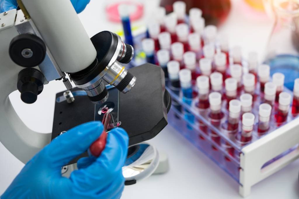 Estados Unidos iniciam testes de nova vacina experimental contra HIV em humanos