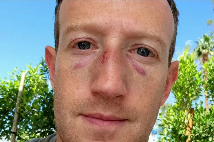 Mark Zuckerberg com hematomas após prática de jiu-jitsu: arte marcial cria condições para que atletas menores e mais leves possam superar mesmo os adversários mais fortes (Instagram @zuck/Reprodução)